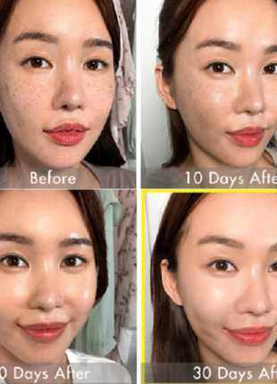 Набор для выравнивания тона кожи some by mi yuja niacin 30 days brightening