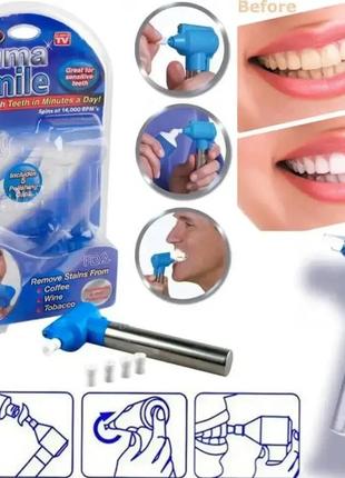 Отбеливатель зубов luma smile | набор для отбеливания зубов вращающийся резиновый валик который полирует зубы8 фото