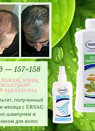 Тонік для укріплення волосся,ерсаг/турція