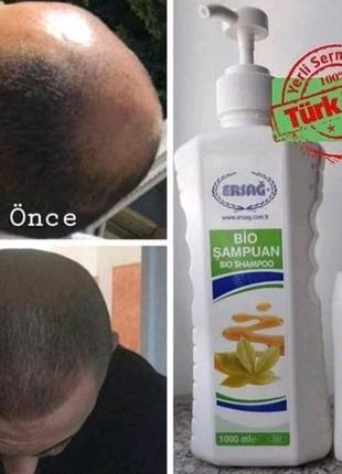 Тонік для укріплення волосся,ерсаг/турція