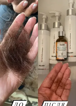 Шампунь проти випадіння волосся hillary serenoa & рр hair loss control shampoo, 500 мл5 фото