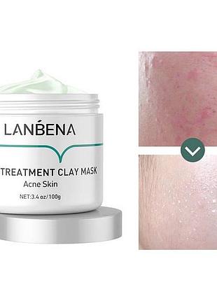 Глиняна маска lanbena для лікування прищів 100г