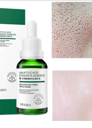 Сыворотка для проблемной кожи контроль жирности и высыпаний venzen salicylic acid❤️❤️❤️