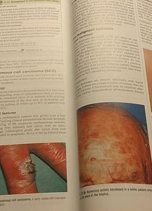 Книга на английском davidson medicina практические принципы клиническая медицина5 фото