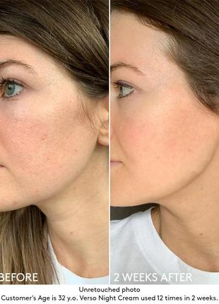 Потужний антивіковий нічний крем з ретинолом verso 3 night cream with retinol 82 фото