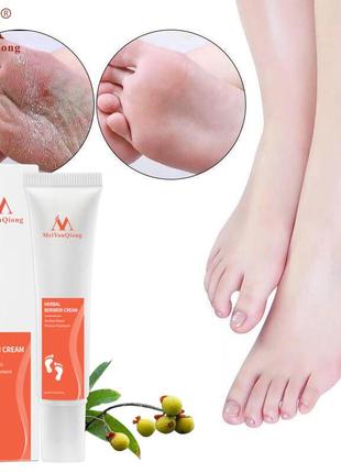 Китайський крем від грибка тріщин ніг beriberi антигрибковий крем антигрибок meiyanqiong