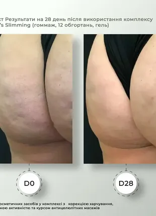 Антицелюлітний ліпосомальний гель hillary anti-cellulite gel lpd's slimming, 200 мл5 фото