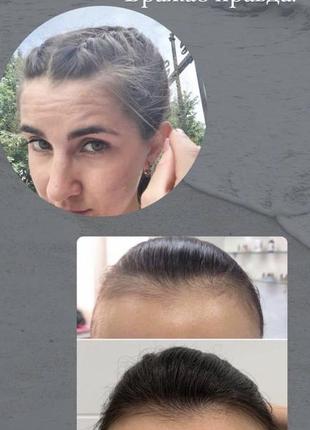Комплекс від випадіння волосся dr.tuna шампунь+маска +концентрат4 фото