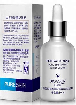 Сироватка анти акне bioaqua pure skin проти прищів і запалень, 30ml (0726)2 фото