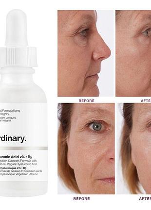 The ordinary - hyaluronic acid 2% + b51 фото