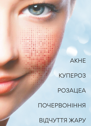 Sesderma azelac moisturizing gel гель для чувствительной кожи с акне, куперозом, розацеа3 фото