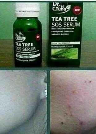 Сироватка sos tea tree5 фото