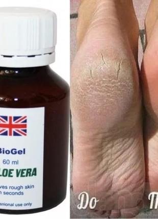 Ремувер кислотный для педикюра biogel aloe vera