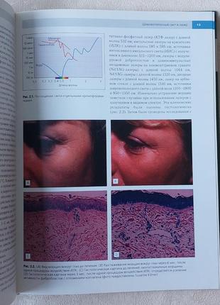 Книга мурад алам, джеффрі зі ст.доувер нехірургічні методи підтягування шкіри6 фото