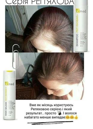 Шампунь «репейный» против выпадения волос с экстрактами лекарственных трав серии l'med®, 250 мл5 фото