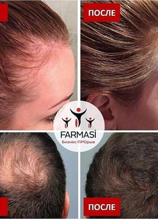 Концентрат чесночного масла для укрепления и роста волос от выпадения волос 30мл. farmasi2 фото