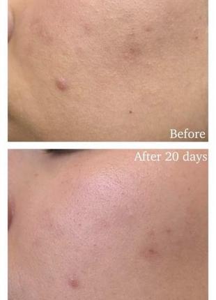 Тоник тонер для лица с кислотами glow recipe watermelon glow pha + bha pore-tight toner, 150 ml