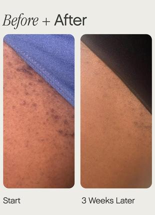 Пробник тоник для вросших волос topicals high roller ingrown hair tonic with aha and bha