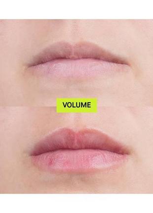 Засіб для додаткового об’єму губ hyalulip volume (hydro-plump lip augmentation) 15 ml2 фото