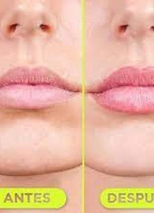 Засіб для додаткового об’єму губ hyalulip volume (hydro-plump lip augmentation) 15 ml3 фото