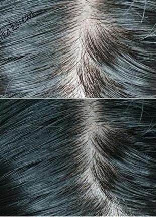 Лікувальний шампунь для жирного волосся ryo hair loss care5 фото