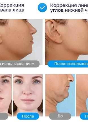 Набор тренажеров для скул. эспандер тренажер для скул, шеи, подбородка, щек и овала лица