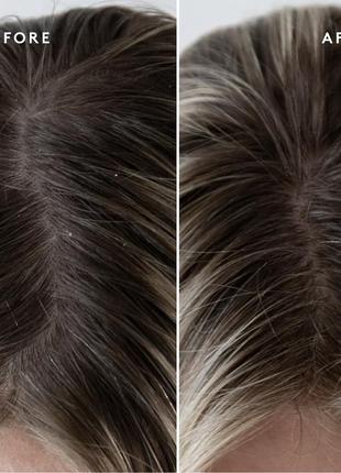 Virtue soothing hyaluronic acid topical scalp supplement сыворотка для кожи головы и волос9 фото