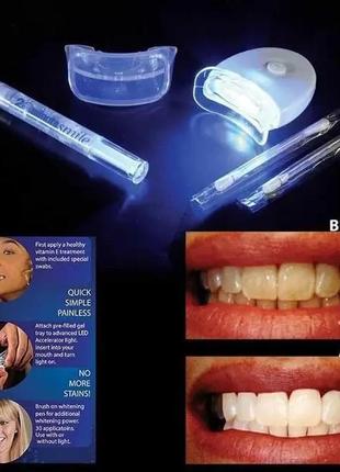 Засіб для відбілювання зубів в домашніх умовах 20 minute dental white4 фото