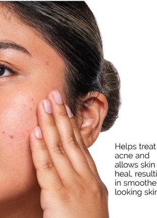 the ordinary the acne set 850