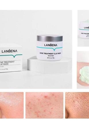 Супер маска от прыщей и угрей для лица глиняная acne treatment clay mask lanbena4 фото