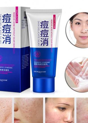 Пінка для вмивання проблемної шкіри bioaqua anti acne remove 100g4 фото