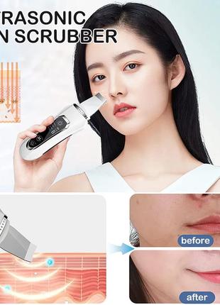 Ультразвуковий скрабер для обличчя ultrasonic facial beauty device4 фото