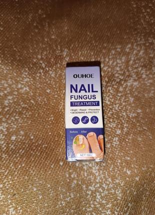 Эффективное средство от грибка ногтей масло для лечения ногтей5 фото