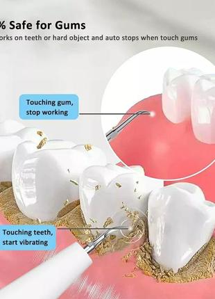 Ультразвуковий скалер, іригатор, видалення зубного нальоту та каменю.7 фото