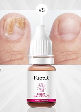 Защитный гель для восстановления ногтей rtopr ginger nail essence 10 мл