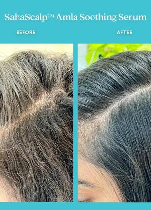 Питательная успокаивающая сыворотка эликсир для кожи головы и волос масло маселка...