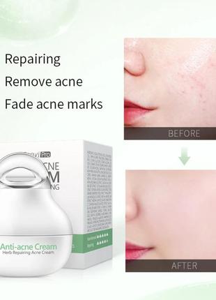 Крем для точечного нанесения fenyi pro anti acne cream herb repairing
