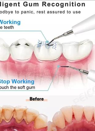 Скалер для чищення зубів peicon2 фото