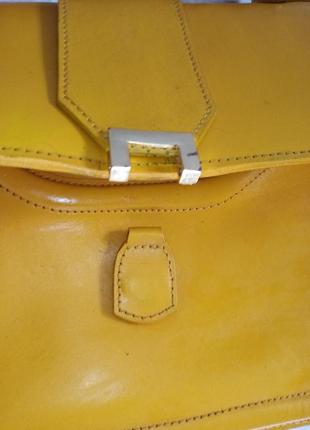 Яскрава жовта шкіряна сумка від asos5 фото