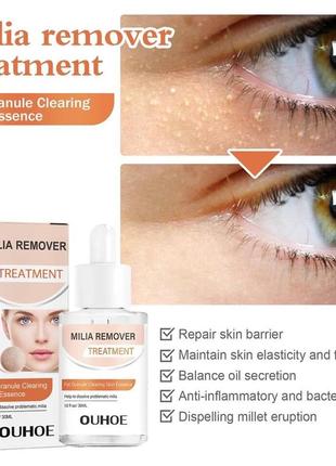 Сиворотка для обличчя remover