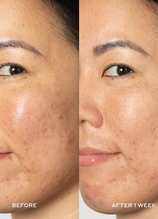 Мощный осветляющий тоник ole henriksen glow2oh dark spot toner против пигментных пятен 190 мл