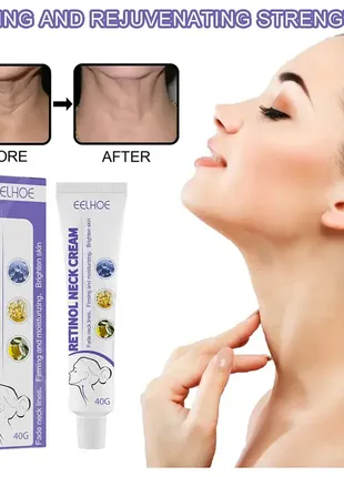 Retinol neck cream для шиї антивіковий крем проти зморщок (40 г)