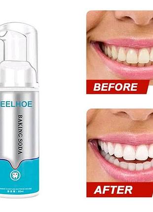Пена для отбеливания зубов💙

натуральные ингредиенты.
уменьшит чувствительность зубов.