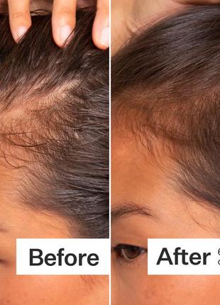 Сыворотка против выпадения и для восстановления поврежденных волос act+acre cold processed stem cell scalp serum5 фото