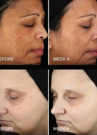 Омолаживающая сыворотка для лица beautystat cosmetics universal c skin refiner с 20% витамином c2 фото