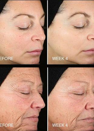 Омолаживающая сыворотка для лица beautystat cosmetics universal c skin refiner с 20% витамином c3 фото