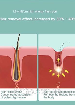 Лазерный эпилятор, 990000 вспышек, перманентный фотоэпилятор ipl, лазерный эпилятор для удаления волос8 фото
