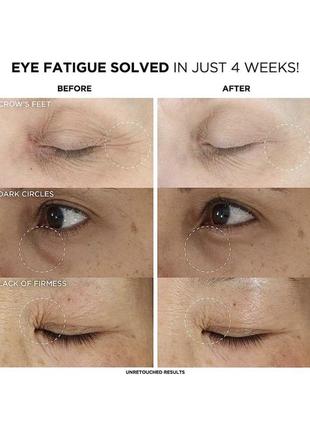 Антивозрастной крем для глаз и век it cosmetics confidence in an eye cream anti-aging peptide3 фото