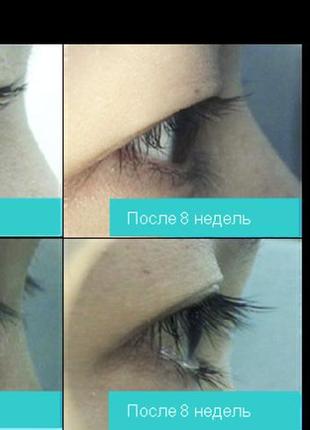 Сыворотка для ресниц magic long eyelash5 фото