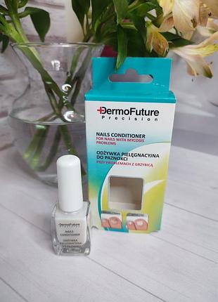 Лечение грибка ноготков dermofuture